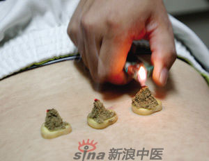 灸法的種類(lèi)  你知道多少？