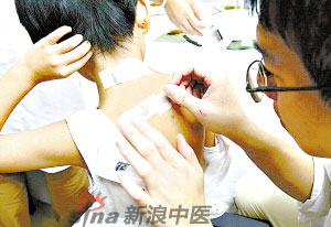 灸法的種類(lèi)  你知道多少？